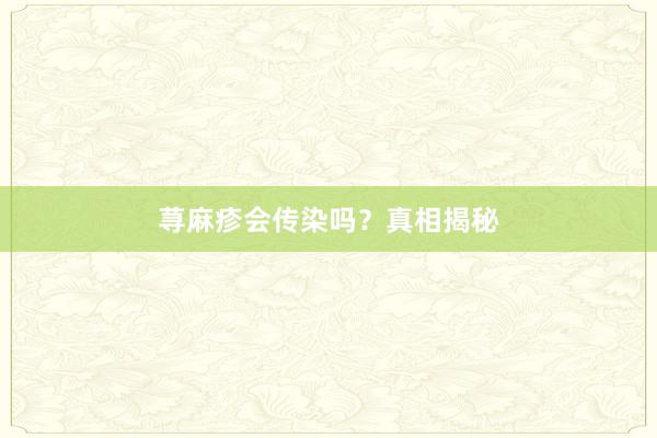 荨麻疹会传染吗？真相揭秘